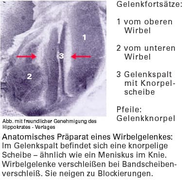 Spinewell für einen besseren Rücken